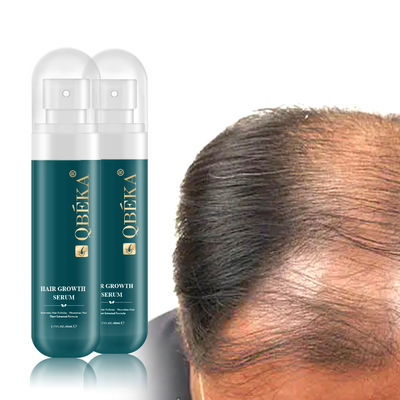 80 ml di siero erboristico per la crescita dei capelli per la prevenzione della perdita di capelli