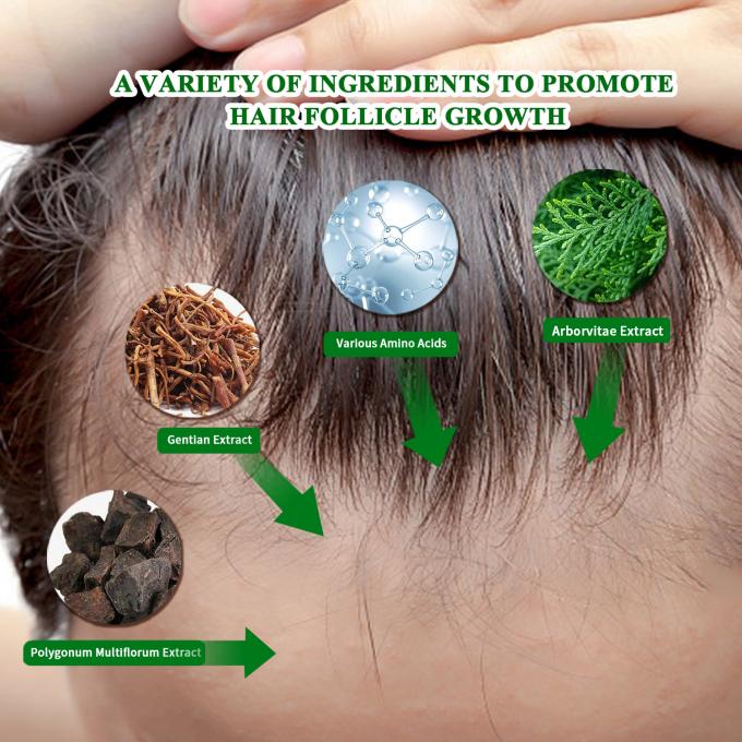 Siero organico per la crescita dei capelli Uso esterno Trattamento per la ricrescita dei capelli Spray anti caduta dei capelli 80 ml 0