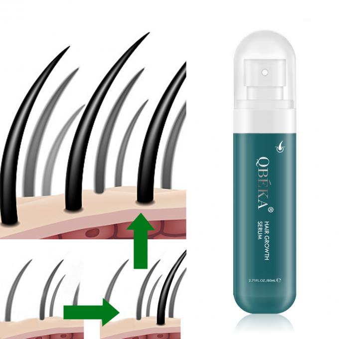 80 ml di olio per la crescita dei capelli Prodotto di etichetta privata Equipe QC professionale Siero anti perdita di capelli 0
