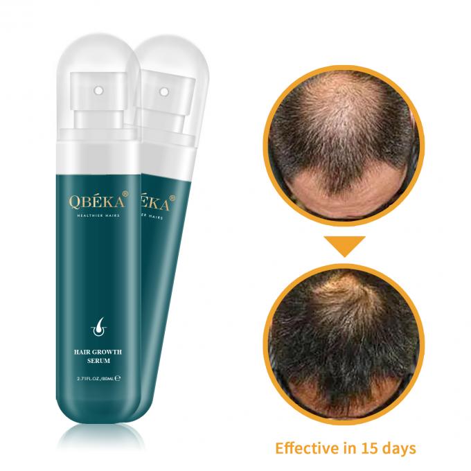 80 ml di olio per la crescita dei capelli Prodotto di etichetta privata Equipe QC professionale Siero anti perdita di capelli 1