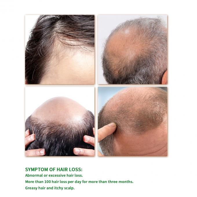 15 Una pianta naturale rara estrae siero per la crescita dei capelli per trattamenti privati con i migliori risultati 1