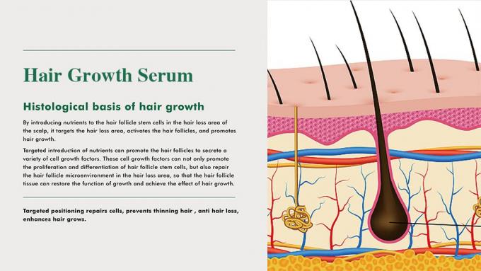 Tonic per capelli a base di erbe per gli uomini Previene la caduta dei capelli Riproduce i capelli Migliora il volume 3 mesi di fornitura 0