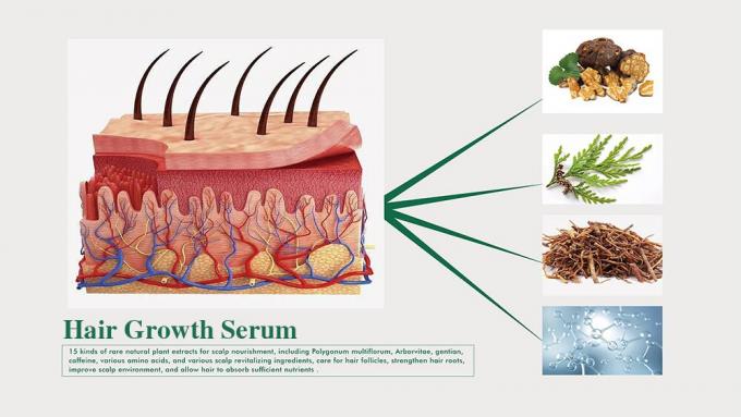 Tonic per capelli a base di erbe per gli uomini Previene la caduta dei capelli Riproduce i capelli Migliora il volume 3 mesi di fornitura 1