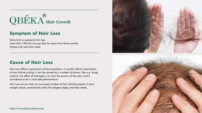 80 ml al giorno di GMPC Trattamento standard per la perdita di capelli maschile eccessiva e il ritiro della linea dei capelli 0