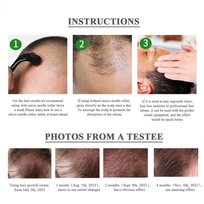 Erbe 7-15 Giorni Siero per la crescita dei capelli Ristabilire il volume e la lucentezza dei capelli senza sforzo 3