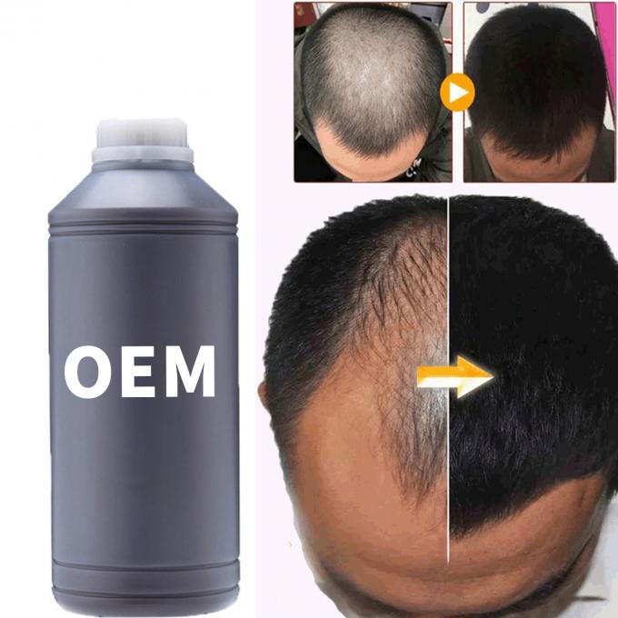 36 mesi durata di conservazione Sero di olio per la crescita dei capelli per tutti i tipi di capelli Cura della perdita dei capelli 3