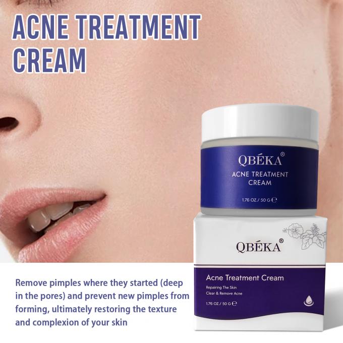 Crema naturale organica per il trattamento dell' acne quantità 1000 2