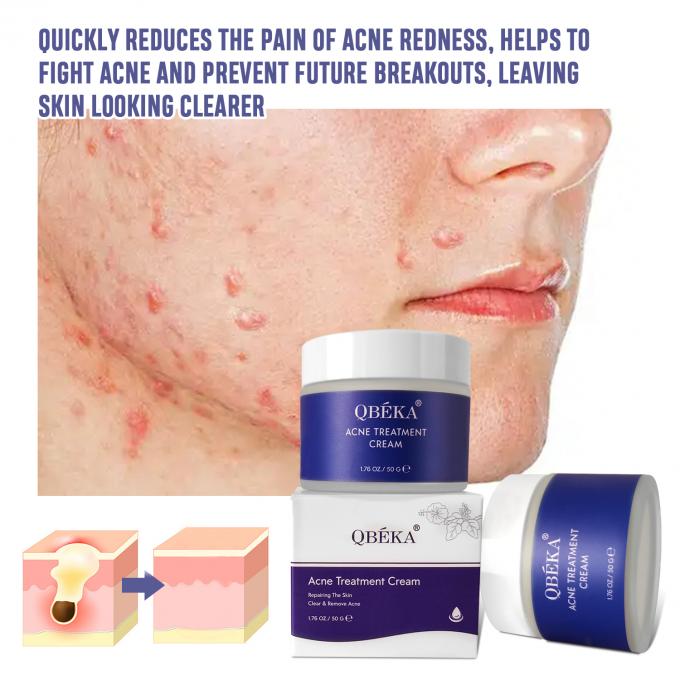 Crema naturale organica per il trattamento dell' acne quantità 1000 5