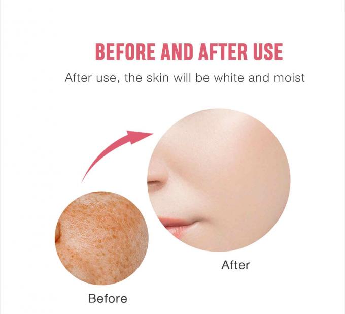 Crema per il viso anti lentiggini a base di glicerina per prodotti OEM/ODM per la cura della pelle 8