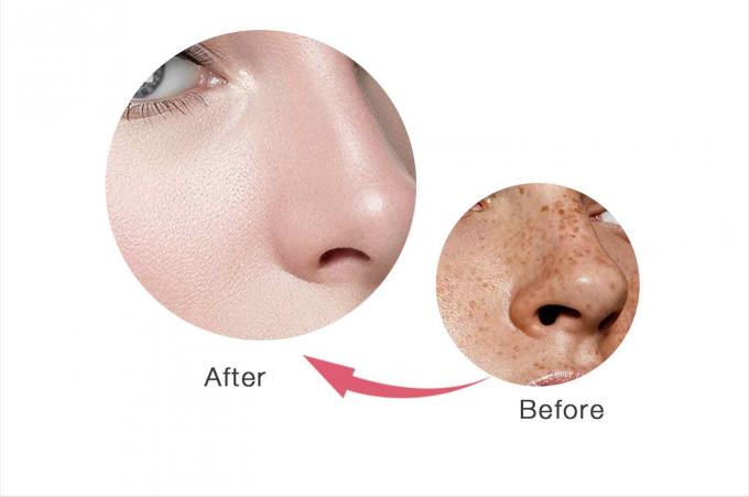 Crema per il viso anti lentiggini a base di glicerina per prodotti OEM/ODM per la cura della pelle 9
