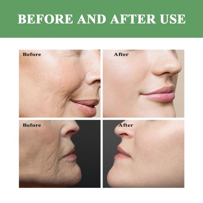 Toner di vitamina C organico per la pelle secca e sensibile 100 ml profumo personalizzato accettato 7