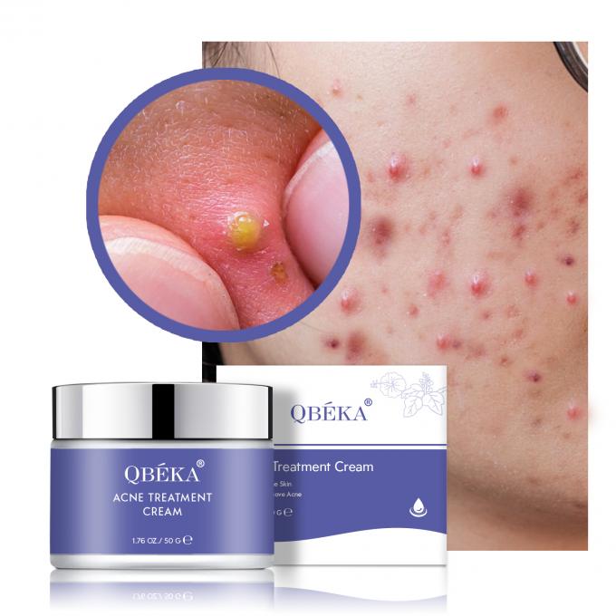 Crema contro l' acne con macchie scure Set erboristico di vitamina C sbiadisce le cicatrici per la rivitalizzazione della pelle femminile 0