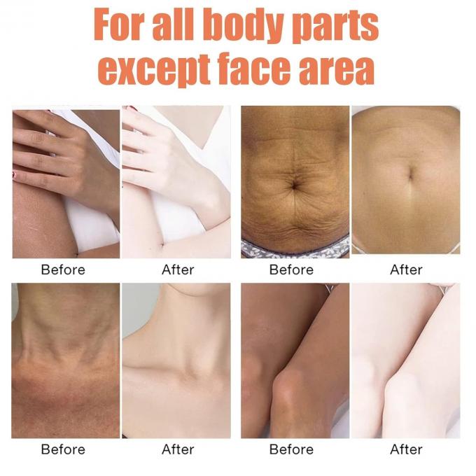 Logo personalizzato Siero del corpo femminile idratante Nutrimento e riparazione per sci lisci e setacciati 1