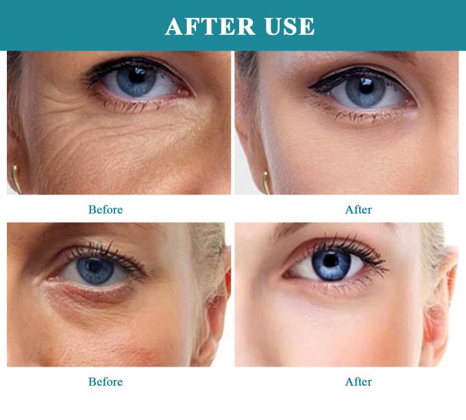 EYE 30 ml di acido ialuronico lucente siero multi-effetto per la cura della pelle anti-invecchiamento vicino a me 6