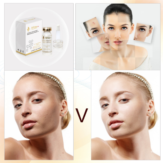 Dimensioni normali Vitamina C organica Purificante Sbiancatore Anti lentiggini Ampolette Quantità 1000 1
