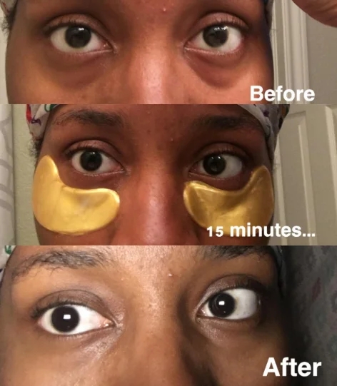 Maschera idratante per gli occhi per ridurre le linee sottili e le rughe 6